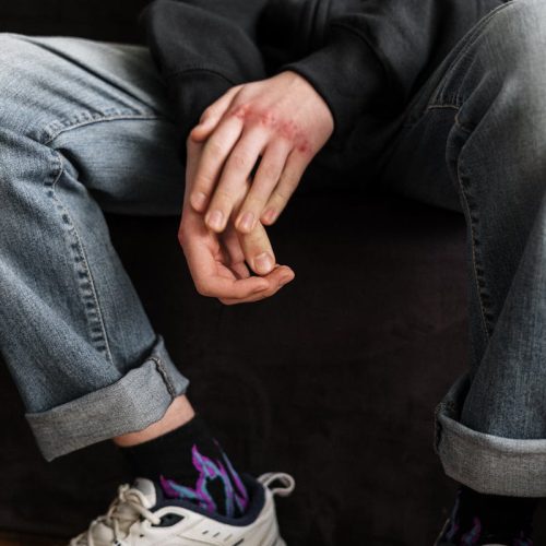 A teenager's folded hands showing injuries, wearing casual jeans and sneakers, sitting indoors.